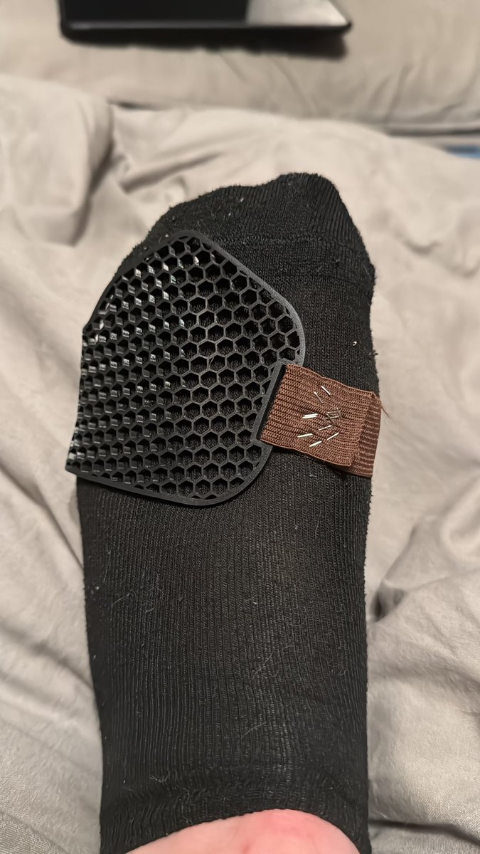 hirt_3dprint's tweet photo. 3D printing can be very useful. I have two broken toes and it wont heal because as a mechanic I am to active. So let’s make my toes stiffer. V1.1 designed in @Shapr3D goes in the test 😅

Of course I used staples 🤣

#3DPrinting #brokenbone https://t.co/txBT4k4p9g