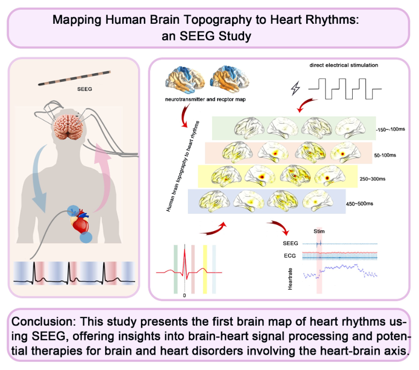 European Society of Cardiology Journals (@esc_journals) on Twitter photo Mapping human brain topography to heart rhythms
Improving our understanding of how the brain processes heart signals & paves the way for novel therapeutic interventions in #CVD
ow.ly/Lib250WiacZ
<a href="/CVR_TomaszGuzik/">CVR Tomasz Guzik</a> <a href="/glenpyle/">Glen Pyle | #WomensHeartHealth ❤️🩹🖇️</a> <a href="/DrMikeDrozd/">Mike Drozd</a> <a href="/Sarah_KBrown/">Sarah Brown</a> #CardiovascularResearch Mapping human brain topography to heart rhythms
Improving our understanding of how the brain processes heart signals & paves the way for novel therapeutic interventions in #CVD
ow.ly/Lib250WiacZ
<a href="/CVR_TomaszGuzik/">CVR Tomasz Guzik</a> <a href="/glenpyle/">Glen Pyle | #WomensHeartHealth ❤️🩹🖇️</a> <a href="/DrMikeDrozd/">Mike Drozd</a> <a href="/Sarah_KBrown/">Sarah Brown</a> #CardiovascularResearch