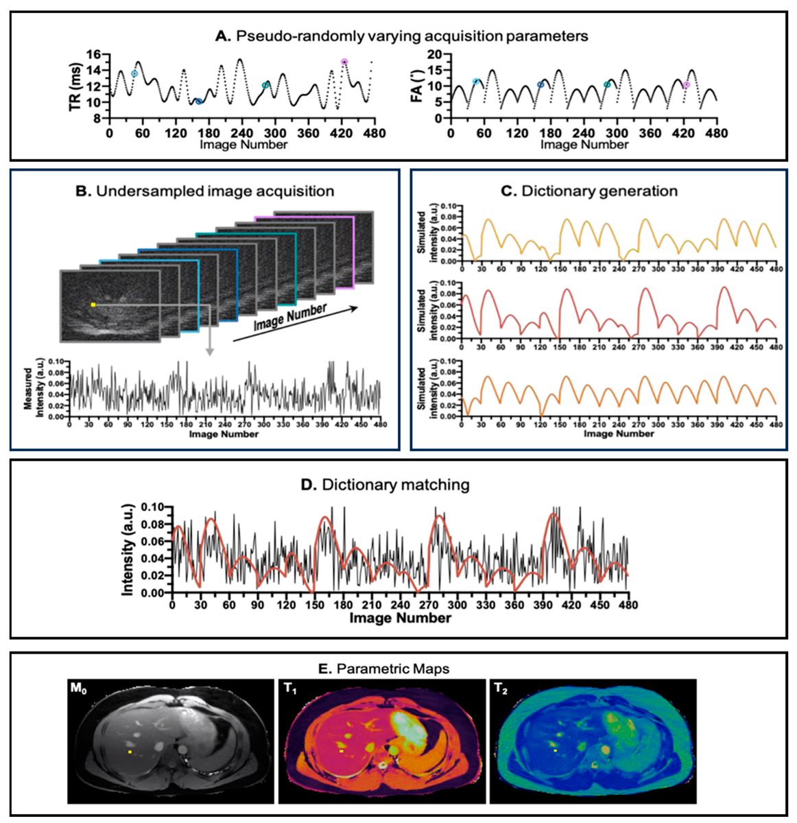 Bioeng_MDPI's tweet photo. 🔬Excited to share the publication "Emerging Trends in Magnetic Resonance Fingerprinting for Quantitative Biomedical Imaging Applications: A Review"👉https://t.co/N94PihvXyU
#MRI #fingerprinting #quantitative_imaging #medical_imaging #image_reconstruction #deep_learning https://t.co/W1PPQ0Jw1F