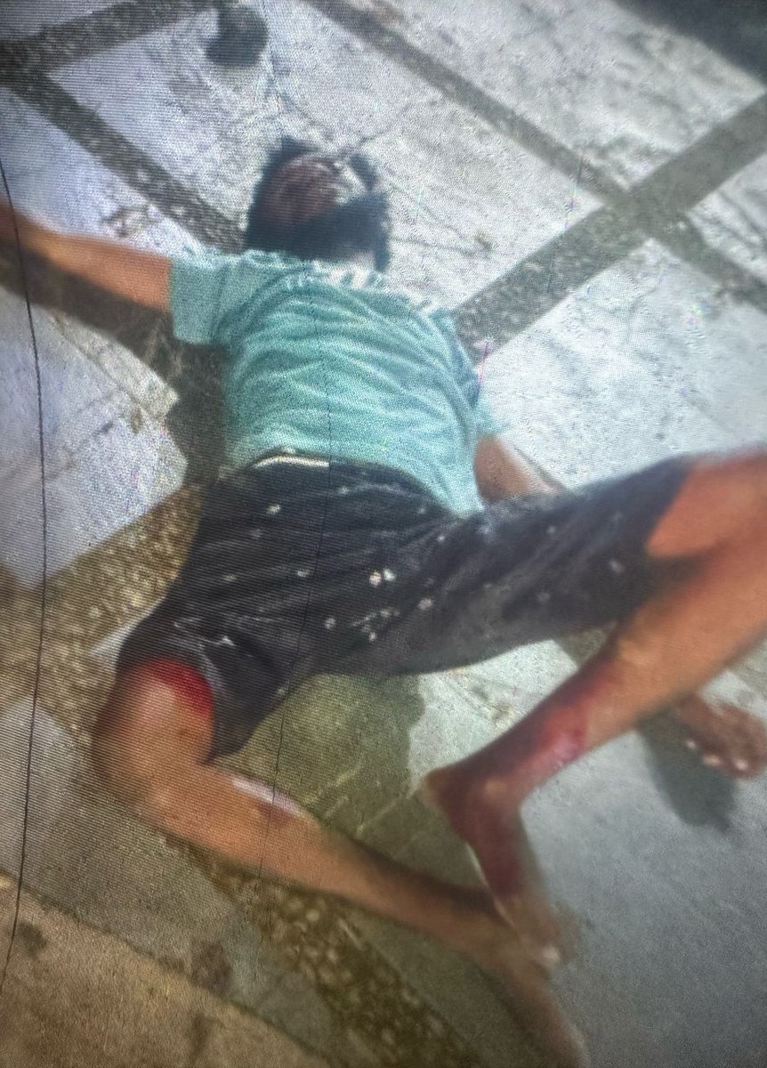 [Papua Occidental] La policia d'ocupació indonèsia torna a excedir-se i dispara a la cama a un civil autòcton sense cap motiu humanrightsmonitor.org/case/police-of…