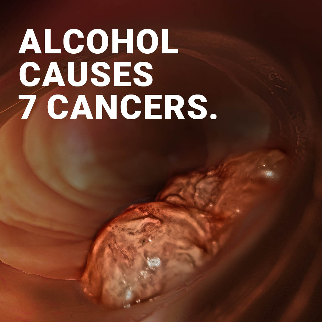 Balance North East (@balancene) on Twitter photo Since we first launched our #AlcoholisToxic campaign, over 130,000 people have visited our Reduce my Risk website for more information on alcohol and support to cut down. This isn’t about alarming people - it’s about sharing health information that people need to know. Since we first launched our #AlcoholisToxic campaign, over 130,000 people have visited our Reduce my Risk website for more information on alcohol and support to cut down. This isn’t about alarming people - it’s about sharing health information that people need to know.