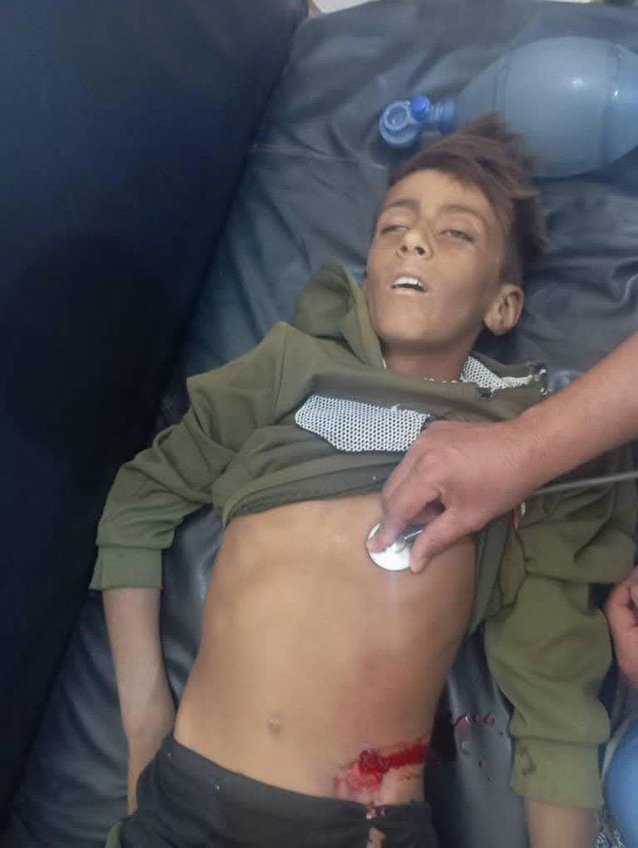 الطفل فريد الهريش، قتلته قسد الإرهابية بدم بارد بالشرقية

وين بيانات الإدانة؟ وين الاستنكار؟ وين ضمير العلوي والدرزي والمسيحي وغيره من الأقليات؟ ولا لانه طفل سنّي من الشرقية؟ وينك يا هند قبوات؟ معقول الدم السني رخيص لهالدرجة وما بيستحق وقفة؟؟