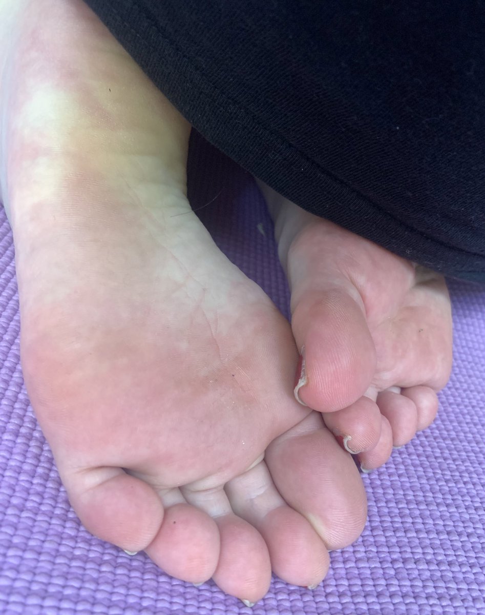敏感に反応してしまいます
#足裏