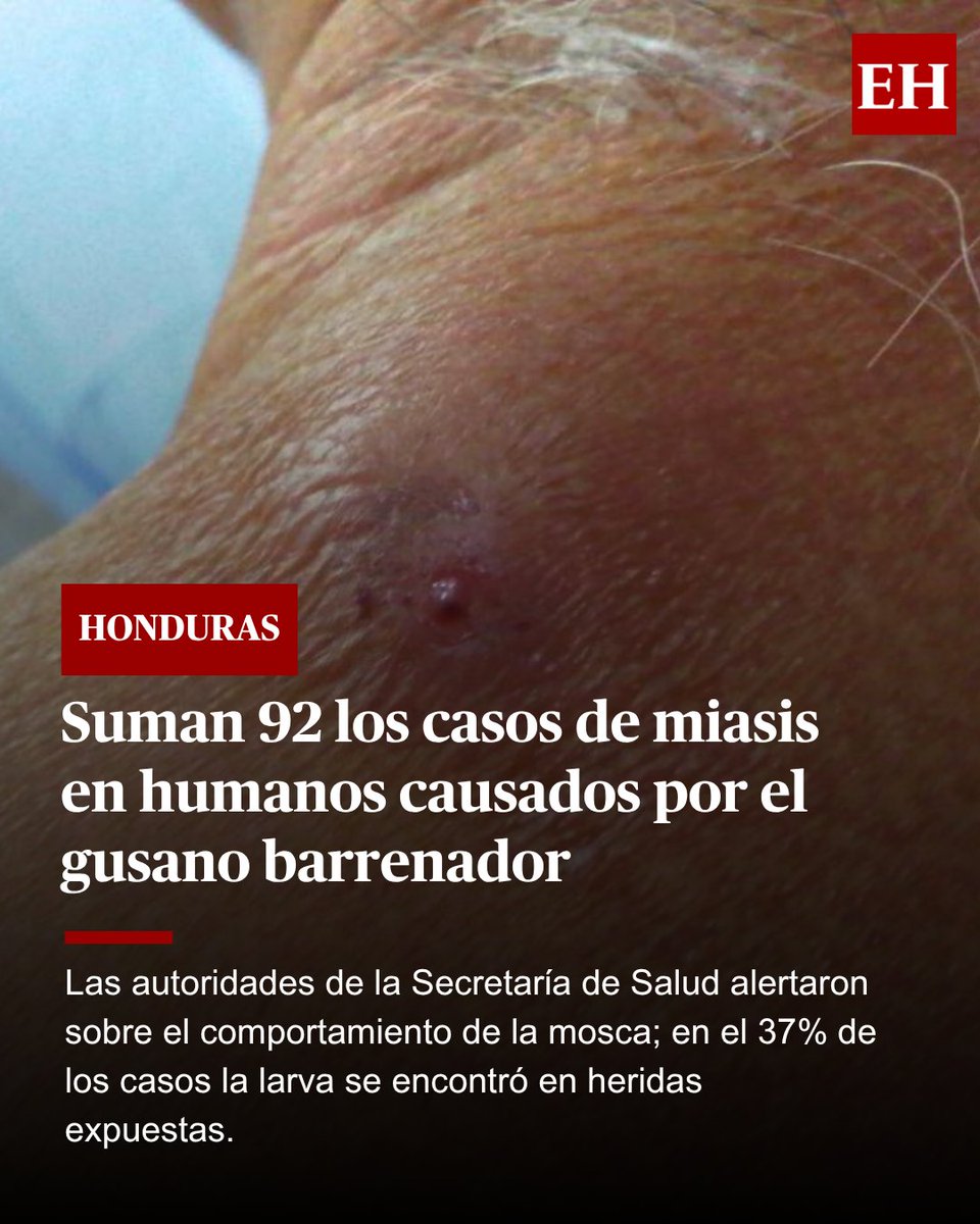 diarioelheraldo's tweet image. El 68% de los casos de miasis que actualmente se registran en el territorio son en hombres; mientras que el 29% es en personas de entre 50 y 59 años. acortar.link/VjJnjz