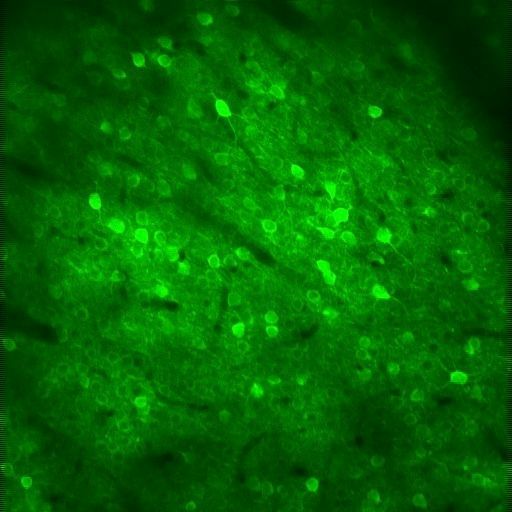 UK Dementia Research Institute (@ukdri) on Twitter photo Research led by Dr Samuel Harris and <a href="/marcaurelbusche/">Marc Aurel Busche</a> reveals a role for the Alzheimer's-linked APP proteins in sustaining brain activity in healthy brains 🧠
The study provides insight into how their disruption could contribute to cognitive impairments👉buff.ly/KcwK7OQ Research led by Dr Samuel Harris and <a href="/marcaurelbusche/">Marc Aurel Busche</a> reveals a role for the Alzheimer's-linked APP proteins in sustaining brain activity in healthy brains 🧠
The study provides insight into how their disruption could contribute to cognitive impairments👉buff.ly/KcwK7OQ