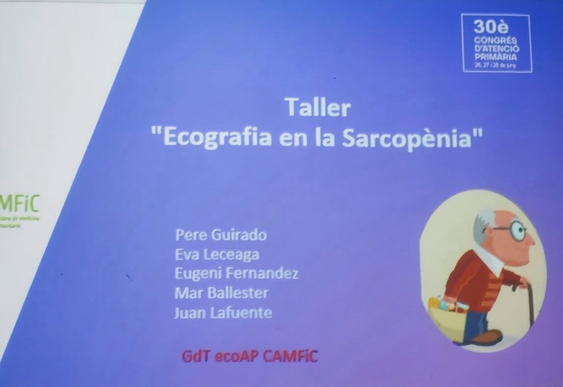 Taller d’Ecografia i Sarcopènia a #AtencióPrimària al #CongresAPCAMFiC 
Un taller pràctic per aprendre a mesurar gruix i qualitat muscular (especialment el quàdriceps) en pacients fràgils amb E. Fernández, E. Lecega, J. Lafuente, M. Ballester, P. Guirado del GdT <a href="/ecoapcat/">ecoap</a>