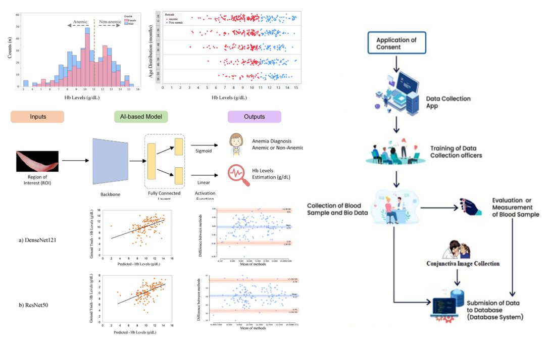 medntdj's tweet photo. CP-AnemiC: A conjunctival pallor dataset and benchmark for anemia detection in children https://t.co/WuArNTFzBb… #Anemia #Hemoglobin #Conjunctiva pallor #Convolutional neural network #Deep learning #Classification #Regression #MedTwitter #scicomm #MedEd #AcademicTwitter https://t.co/oND6jxOhhW