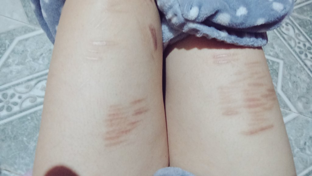 sku7i9j's tweet photo. alguien que le guste los cortes? ese brasileño me dejó re traumada... quiero su verga otra vez, cortarme y que se venga con eso 😵‍💫 #Pintoawards #nsfwtwť #shtwtᅠ #goonertalk https://t.co/muoWCecza7