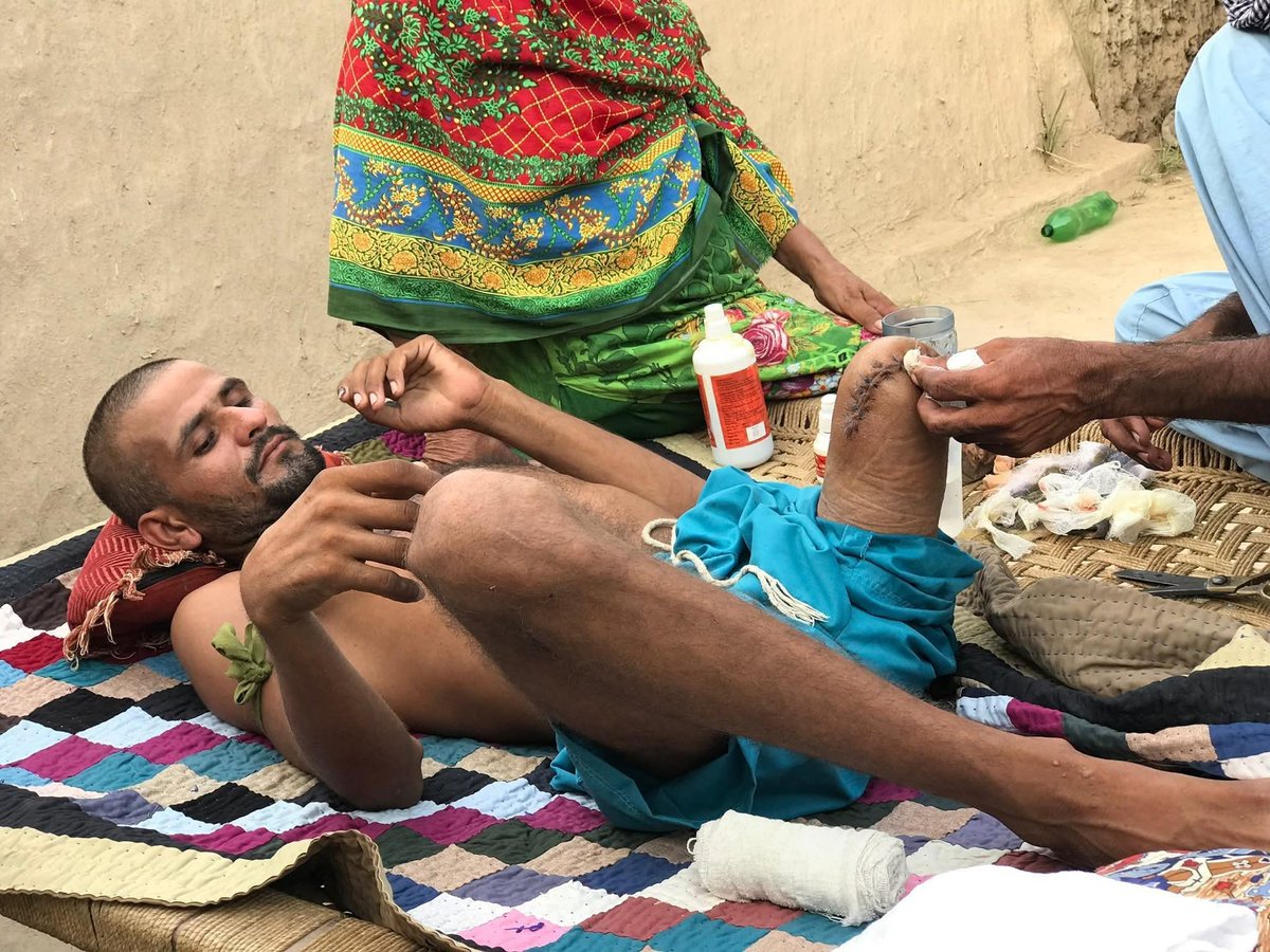 Dilbar Laghari was protesting against the 6 illegal canals on indus river, while protest state killed 02 protestors and 01 Dilbar Laghari half fried , the human rights violation by the state  is totally state terrorism at Sindh Pakistan.
#JusticeForDilbarLaghari