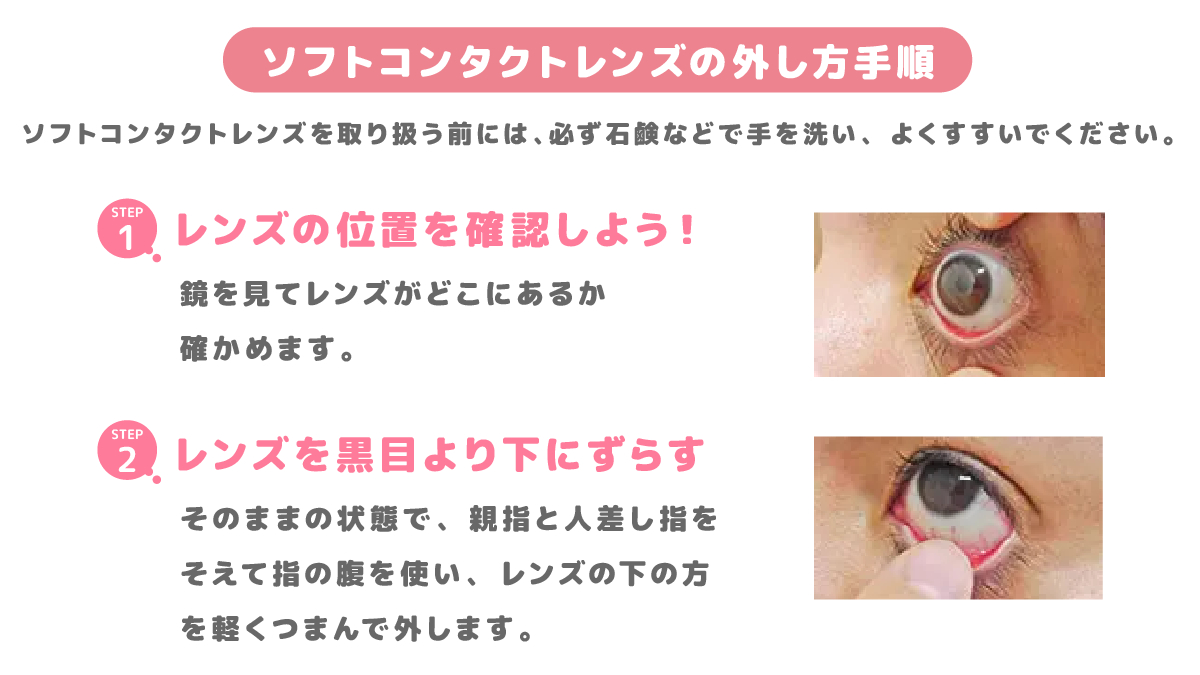 Ace_Contact_jp's tweet image. ⋱保存して見返そう！⋰
#ソフトコンタクトレンズ の正しい外し方💡

5月の「正しい付け方」投稿に続き、今回は「正しい外し方」編！

適切な手順・方法をマスターして、安全にソフトコンタクトレンズを使用しましょう🧑‍🏫

詳細は画像をご覧ください👀