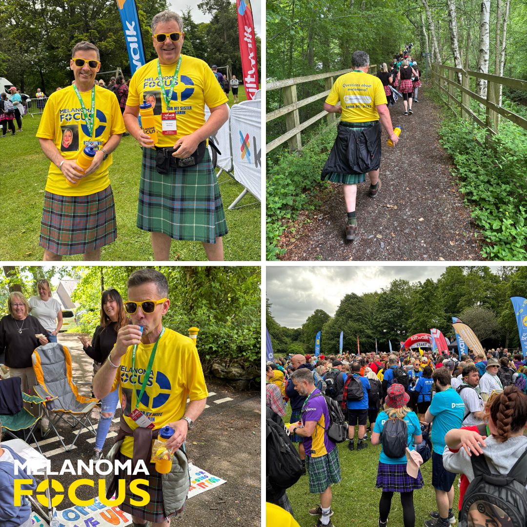 Karin sadly passed away from melanoma during 2024. Her husband Craig &amp; her brother Ronald wanted to do something special to honor her memory. They recently completed the Aberdeen Kilt Walk, an 18 mile walk in 5 hours! A huge thank you &amp; well done to them. buff.ly/l62BKKs