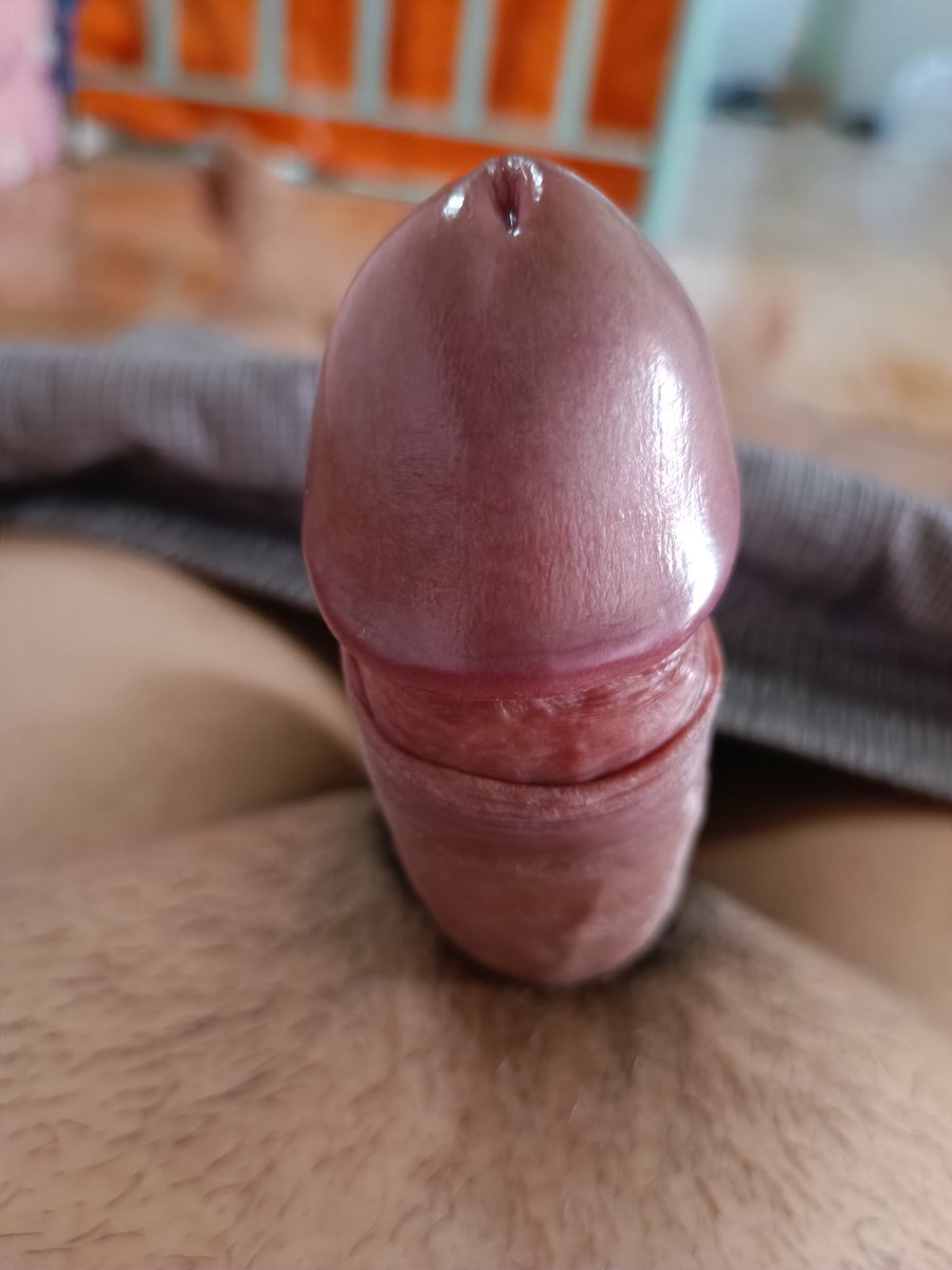 Thiếu người chăm sóc e nó