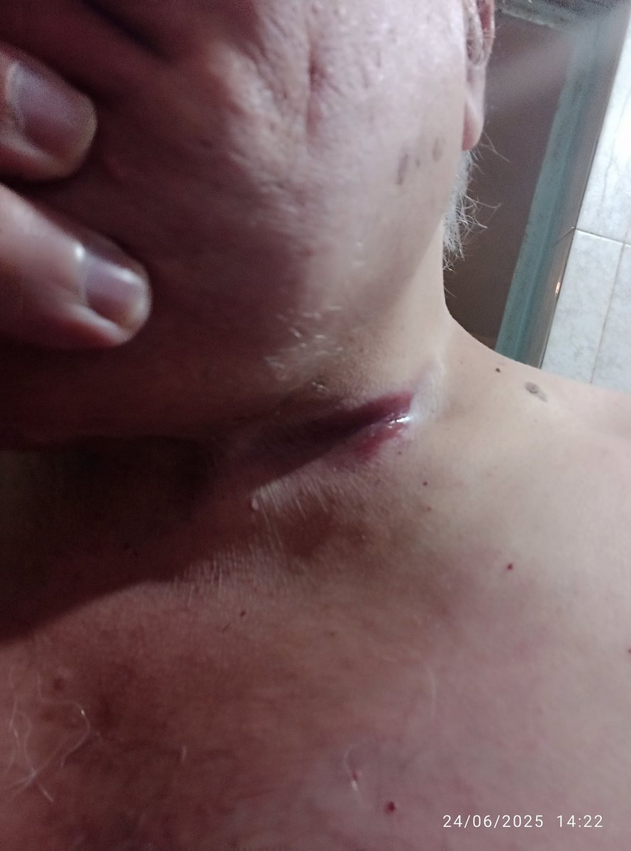 diep_flors's tweet photo. AYUDA Presidenta @Claudiashein
@GobiernoMX
@Defensamx1 ya son 11 años 24/7 que agresor electrónico y cómplices en Tecno del estado, me atacan!!! Yo adulto vulnerable,me acaban de inducir criminal pesadilla, antenoche Jun24 por 3a vez me quemaron!!!#Amenazas #V2k #GobiernoDeMéxico https://t.co/7UAfihjd3h