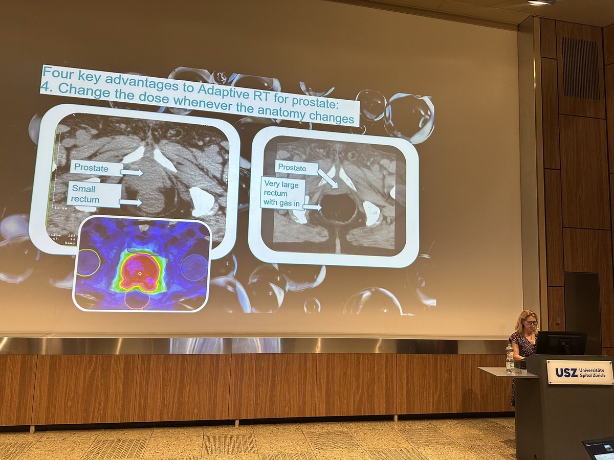 Giulia Marvaso (@giuliamarvaso84) on Twitter photo 'Better technology cures more patients with less side effects' quoting <a href="/alison_tree/">Alison Tree 💙</a> at the MR and RT symposium in Zurich today! #radiotherapy #ProstateCancer #RadoncGU 'Better technology cures more patients with less side effects' quoting <a href="/alison_tree/">Alison Tree 💙</a> at the MR and RT symposium in Zurich today! #radiotherapy #ProstateCancer #RadoncGU