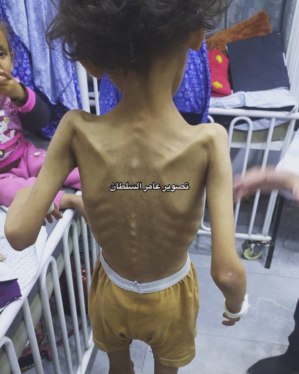 If you see this little angel, reply with 💔🇵🇸

We're still starving.