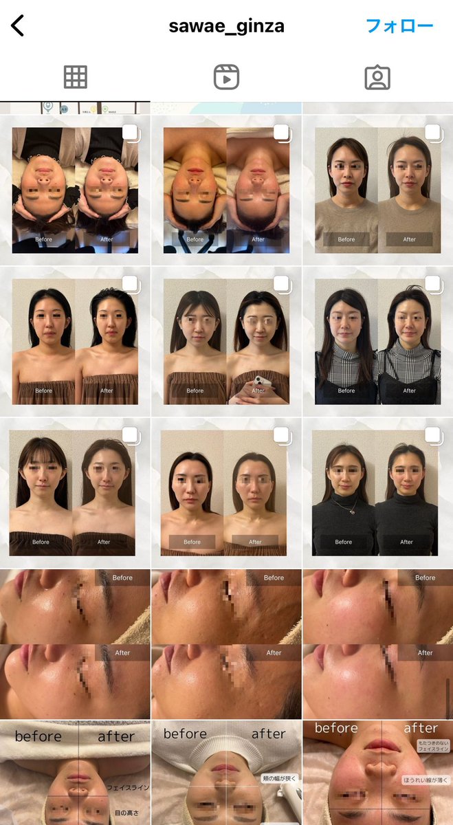 サロン経営をしているとホットペッパーで★5をとる事の難しさを痛感するのだけど、ここのヘッドスパはまじで星5すぎた...ヘッドスパで癒されながらも小顔になりたい、を同時に叶えてくれる神サロン。