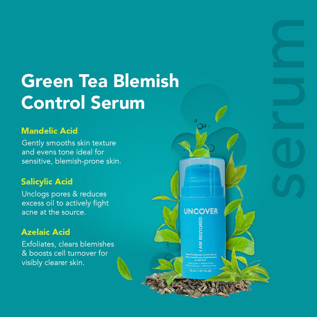 SiapaiS's tweet photo. 🌿 GREEN TEA BLEMISH CONTROL SERUM 🌿
Restore your skin. Restore your confidence.

This powerful serum is packed with green tea goodness to:
✨ Reduce acne and blemishes
✨ Unclog and refine pores
✨ Prevent future breakouts
✨ Protect and strengthen your skin barrier
#SSOX https://t.co/LRofsTUexp