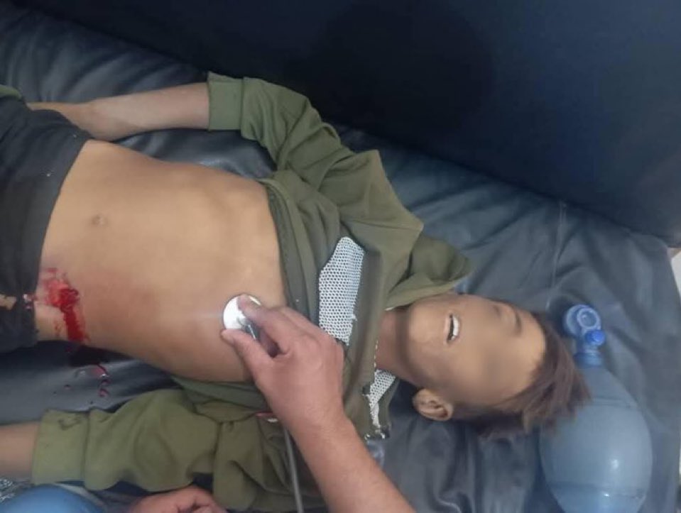 طفلان حاولوا منع عناصر ميليشيا قسد من سرقة خضار أرضهم في دير الزور… فكان الرد بالرصاص!
النتيجة: استشهاد فريد الهريش وإصابة محمد الحمدون بجروح خطيرة.
مشهد جديد من عربدة السلاح واستهتارهم بدماء الأبرياء في الجزيرة السورية.
رحمه الله، والشفاء للمصاب.