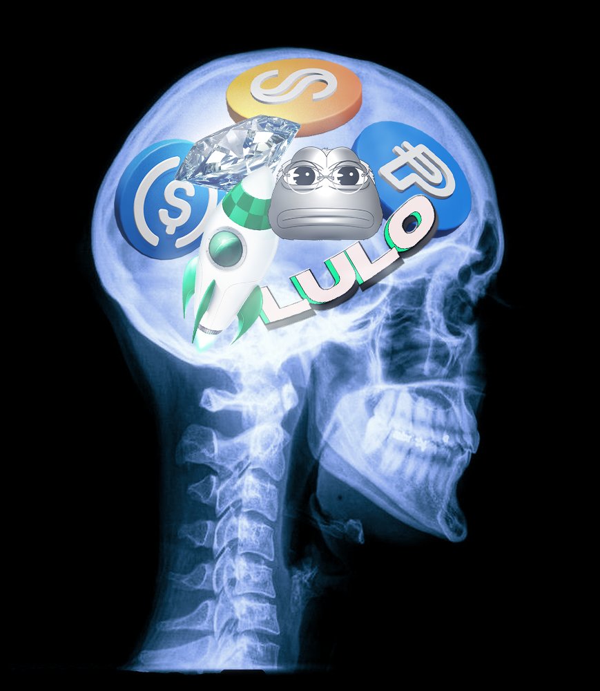 "What's on your mind bro?"