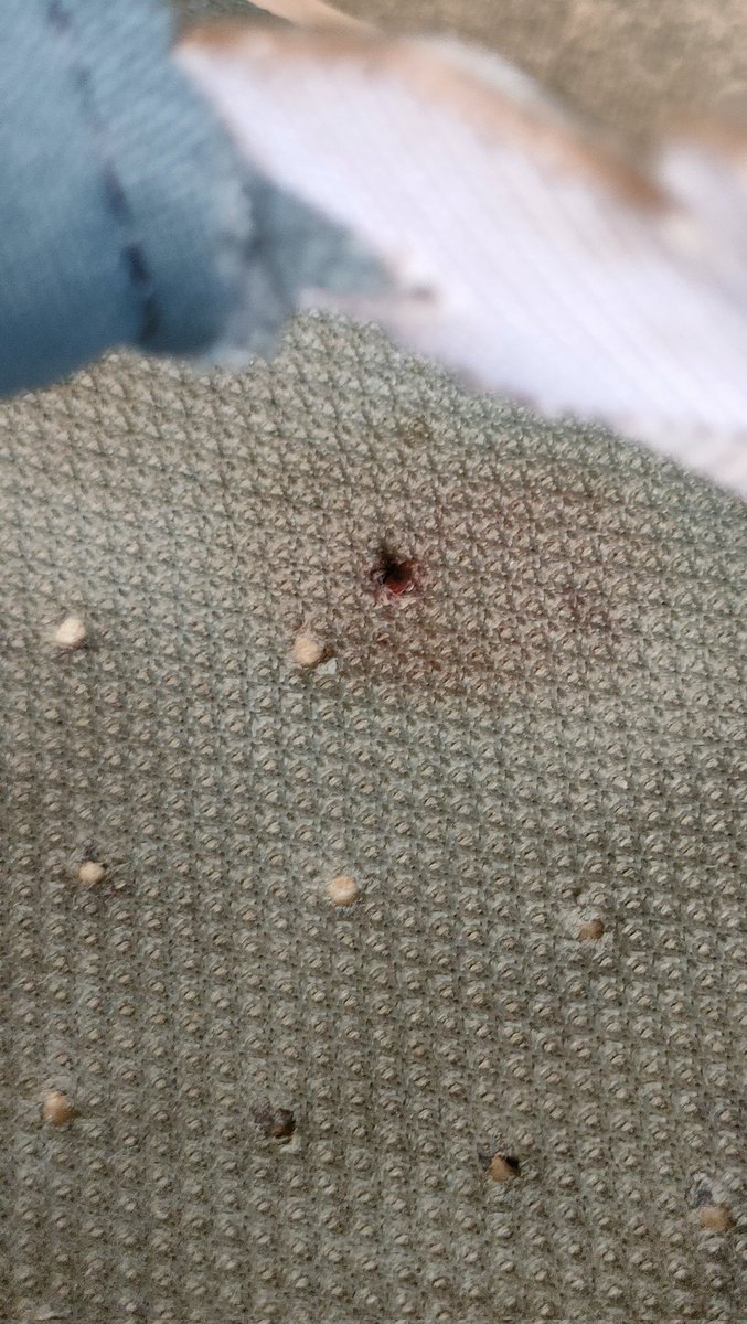 fatoldred's tweet photo. @hoka my running shoes have suddenly developed an issue whereby a very sharp point is sticking through the sole into my foot? I'm very disappointed this has happened, can you assist? https://t.co/c7PCtiamu0