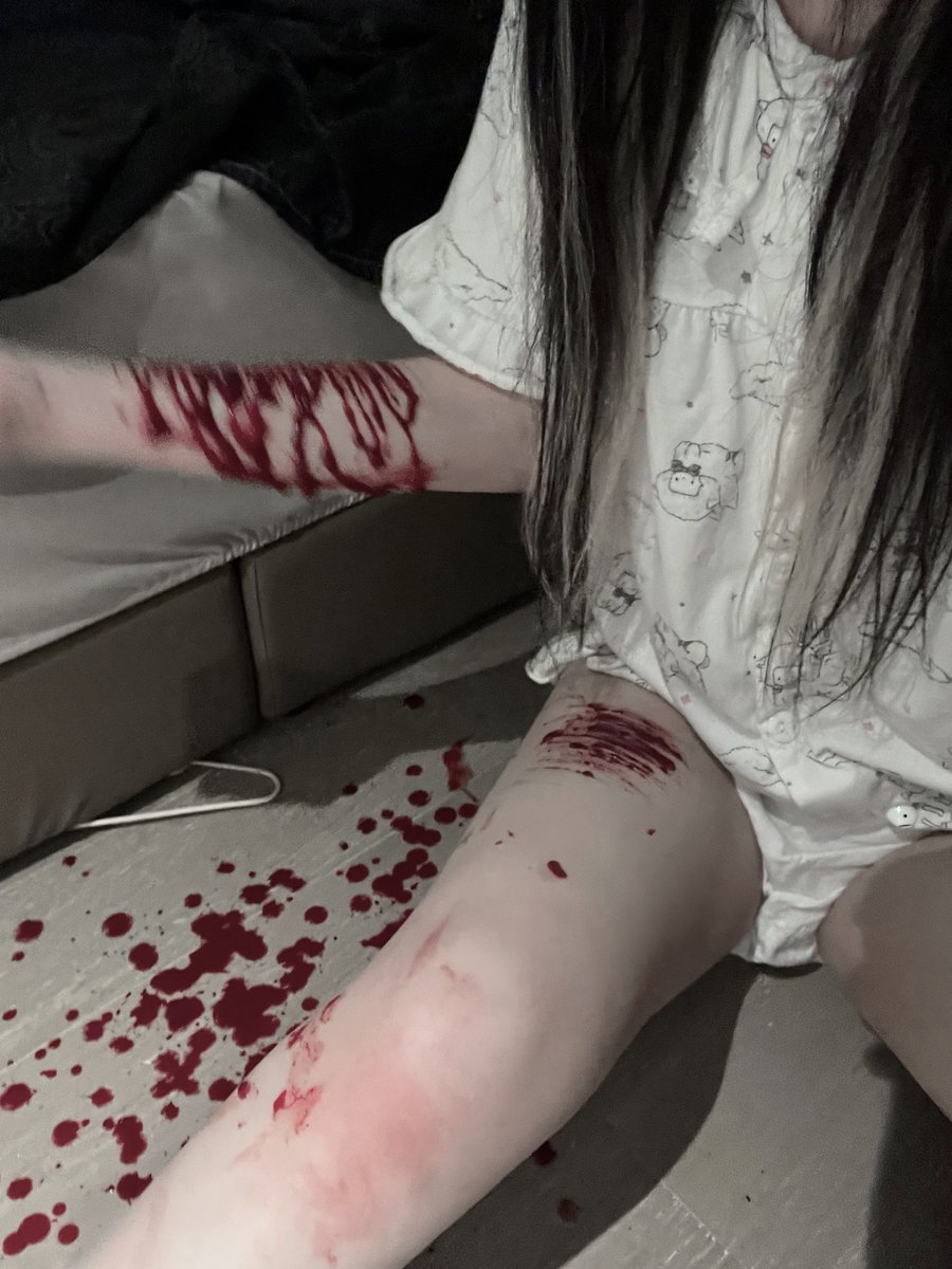 sukixi_ovo's tweet photo. ロリボディね
#shtwt #リスカ #病み垢女子 https://t.co/Ukg3lkQLqn
