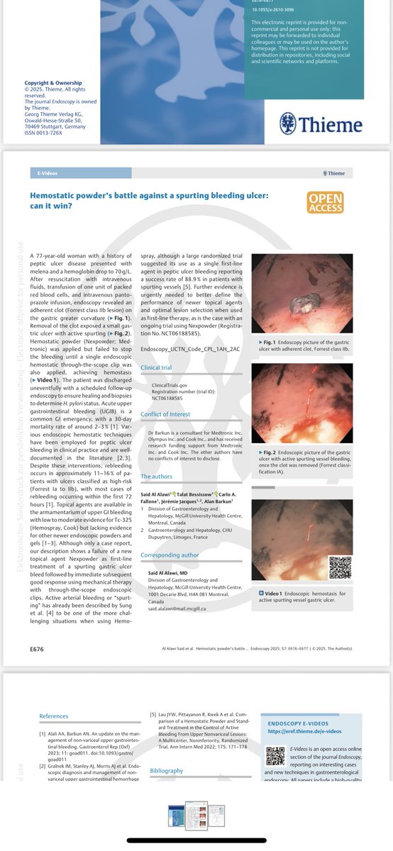 Said Al Alawi (@said_ghasib) on Twitter photo Excited to share:
New publication at <a href="/ThiemeIntl/">Thieme International</a>
lnkd.in/dQvkRaGg
Hemostatic powder’s battle against a spurting bleeding ulcer: can it win?
With the GI bleeding experts <a href="/alan_barkun/">Alan Barkun</a> <a href="/TBessissow/">Talat Bessissow</a> <a href="/JACQUESjer31657/">JACQUES jeremie</a>
<a href="/cusm_muhc/">Centre universitaire de santé McGill</a> Excited to share:
New publication at <a href="/ThiemeIntl/">Thieme International</a>
lnkd.in/dQvkRaGg
Hemostatic powder’s battle against a spurting bleeding ulcer: can it win?
With the GI bleeding experts <a href="/alan_barkun/">Alan Barkun</a> <a href="/TBessissow/">Talat Bessissow</a> <a href="/JACQUESjer31657/">JACQUES jeremie</a>
<a href="/cusm_muhc/">Centre universitaire de santé McGill</a>