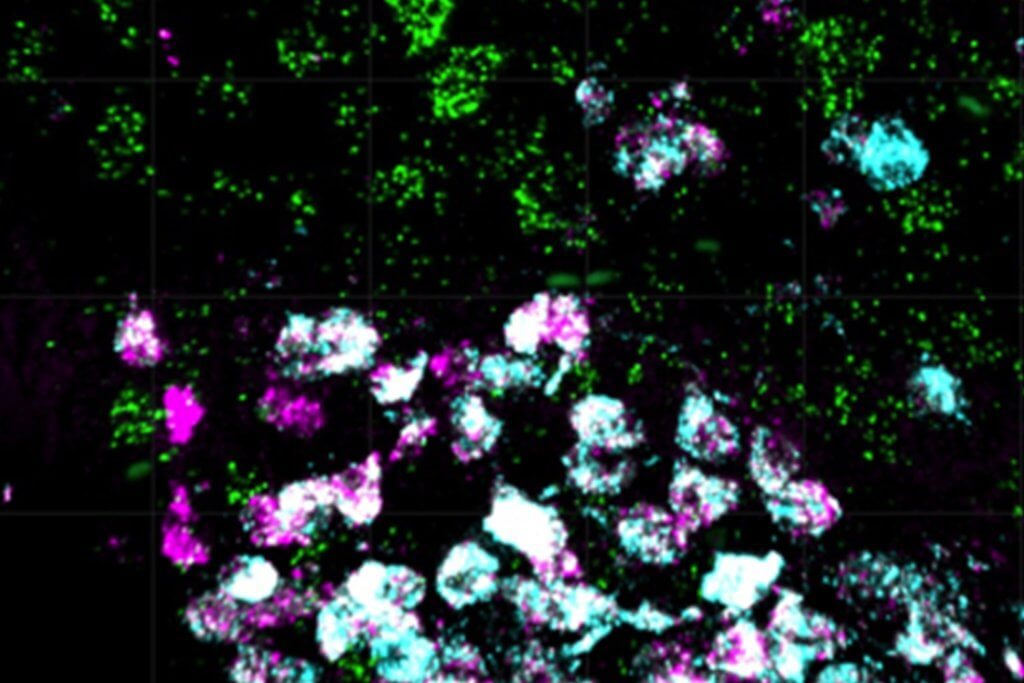 Newly discovered nerve cells in the brains of mice, controlled by leptin, could lead to novel obesity treatments in humans. Explore the research from <a href="/MPI_Metabolism/">Max Planck Institute for Metabolism Research</a>: maxplanckneuroscience.org/newly-identifi…