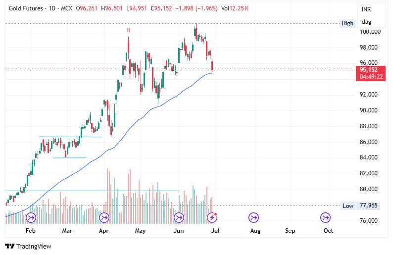 shilpajain1901's tweet image. #GOLD make or break zone 

Important level 94400 closing basis 

#Silver #commodities
