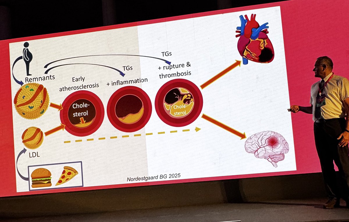 drpablocorral's tweet image. A must-read in the field of cardiovascular prevention:
“Residual cardiovascular risk beyond LDL-C: inflammation, remnant cholesterol, and lipoprotein(a)”
by Anders Wulff and Prof. Børge Nordestgaard, just published in the European Heart Journal (2025).
This editorial…