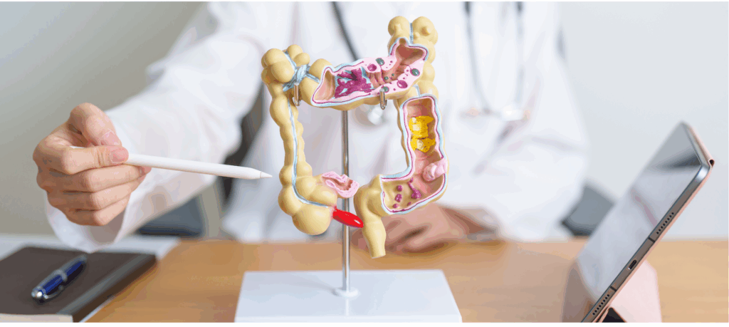 American Gastroenterological Association (AGA) (@amergastroassn) on Twitter photo π£ Our clinical practice guideline on the management of moderate-to-severe Crohn's disease is now open for public comment! Publication in <a href="/AGA_Gastro/">Gastroenterology</a> is set for this winter.
π Review the draft and submit comments by July 20: ow.ly/775N50Wh65L
#GItwitter #CrohnsDisease π£ Our clinical practice guideline on the management of moderate-to-severe Crohn's disease is now open for public comment! Publication in <a href="/AGA_Gastro/">Gastroenterology</a> is set for this winter.
π Review the draft and submit comments by July 20: ow.ly/775N50Wh65L
#GItwitter #CrohnsDisease