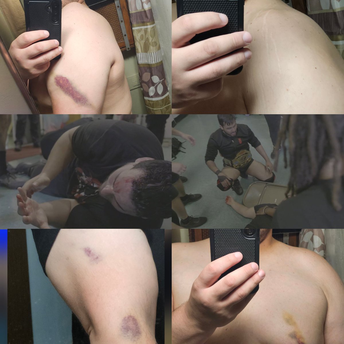 Principal owner <a href="/JoakimMorales/">The Main Meme Ever Joakim {Grip Daddy} Morales</a> heads into surgery today to repair his right shoulder after the heinous attack following Fight For Pride 2. We will update you shortly.