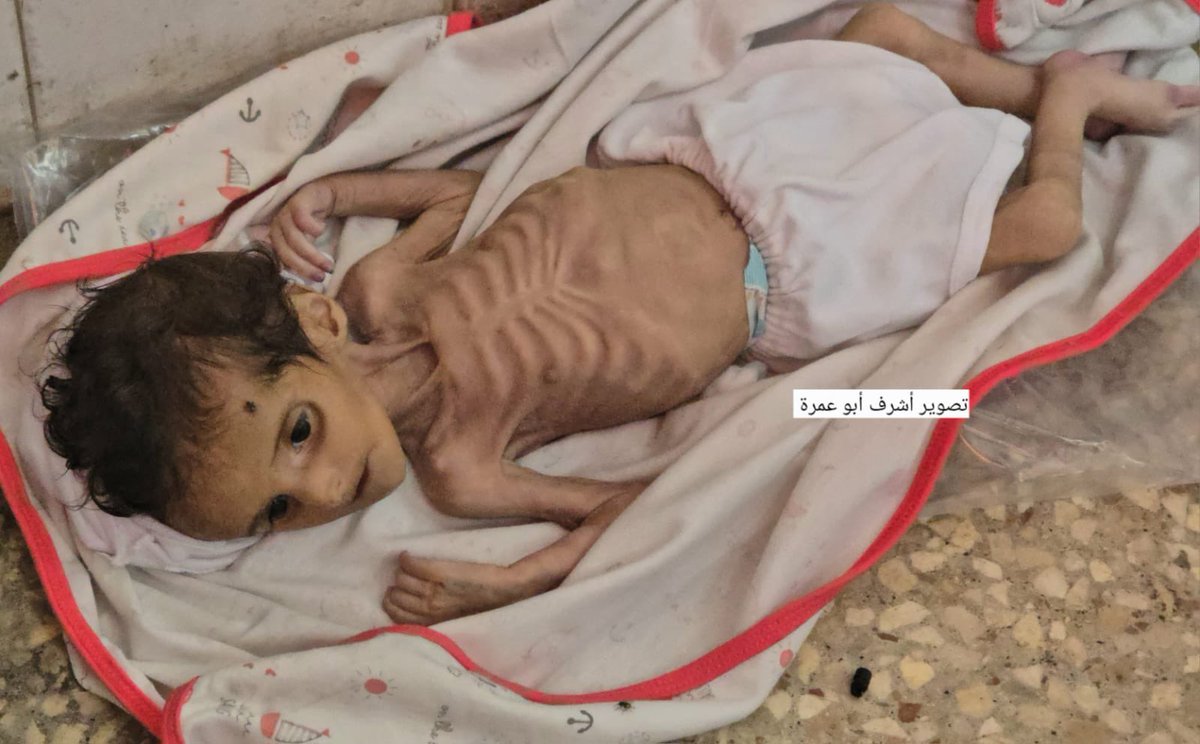AbujomaaGaza's tweet photo. Little baby Jory al Masri has passed away due to lack of formula and severe malnutrition! https://t.co/V9r2iUAUPP
