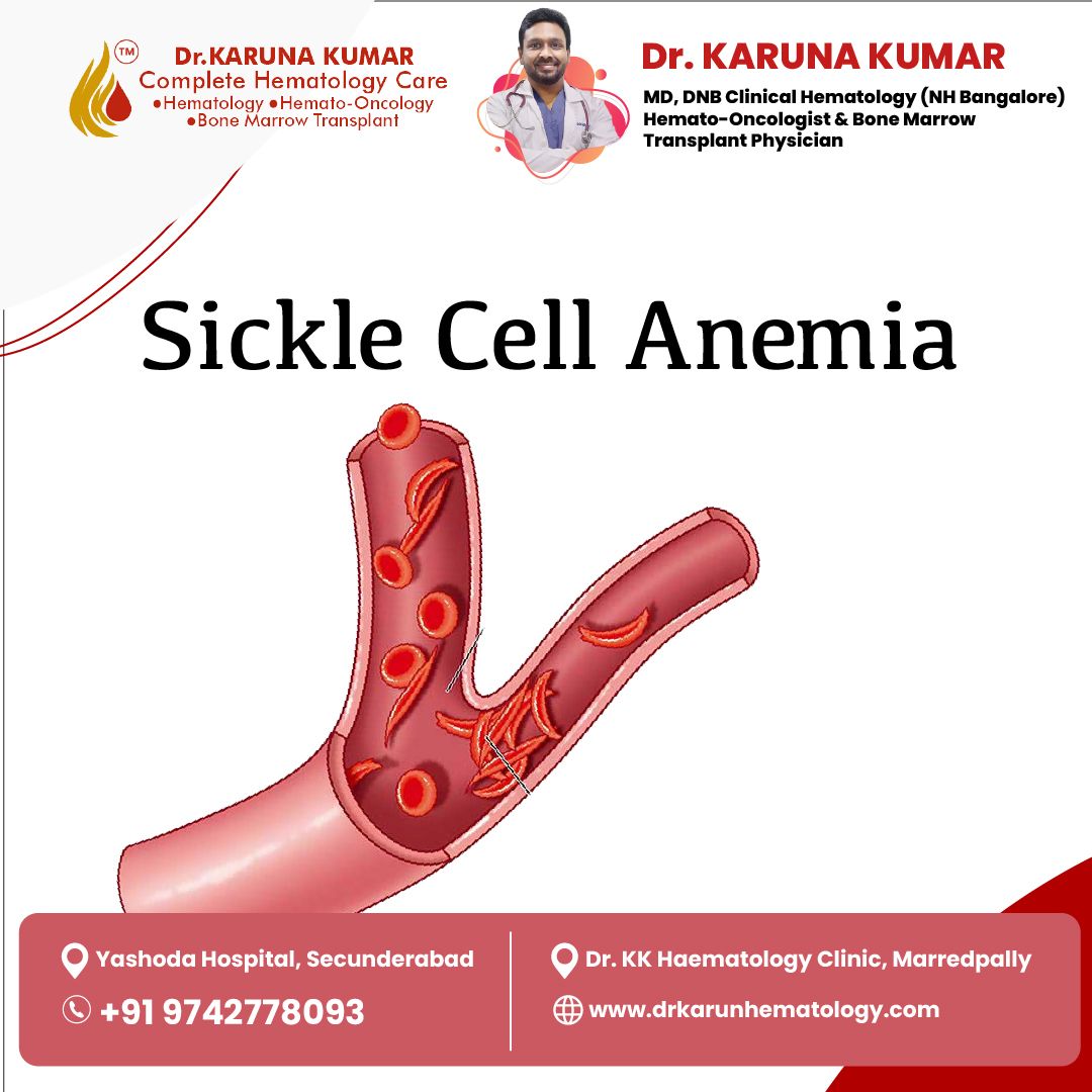 Drkkhematology's tweet image. Different types of anemia need different treatments.
Get the right diagnosis with Dr. Karuna Kumar.
#AnemiaAwareness #TypesOfAnemia #HematologyCare