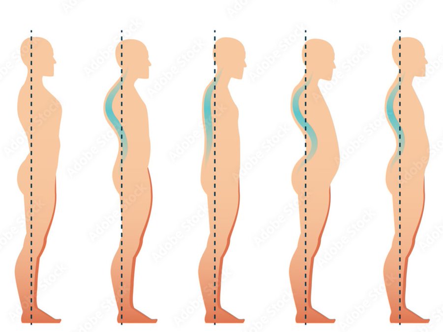 Slumped Shoulders wreck your Posture!

Get rid of them with this Mobility Tutorial. 

Including 6 Frontal Line Openers.

For all Levels.🧵