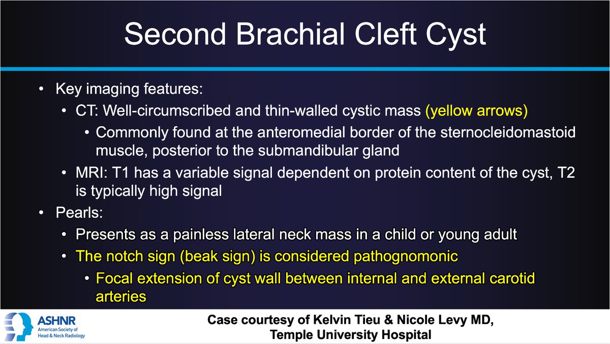 ASHNRSociety's tweet image. #ASHNRCOTW #303: ANSWER. Thx Kelvin Tieu and Dr. Levy 4 case! #ASHNR25
@callyrobs @DShatzkes @CDP_Rad @rhwiggins
@nakoontz @KRileyMD @CMGlastonbury @tabby_kennedy @PhilipRChapman1 @cmtomblinson
@amyfjuliano @bpoliceni @MohitTCCNeuro @AshokSrini15 @KatieTraylorDO…