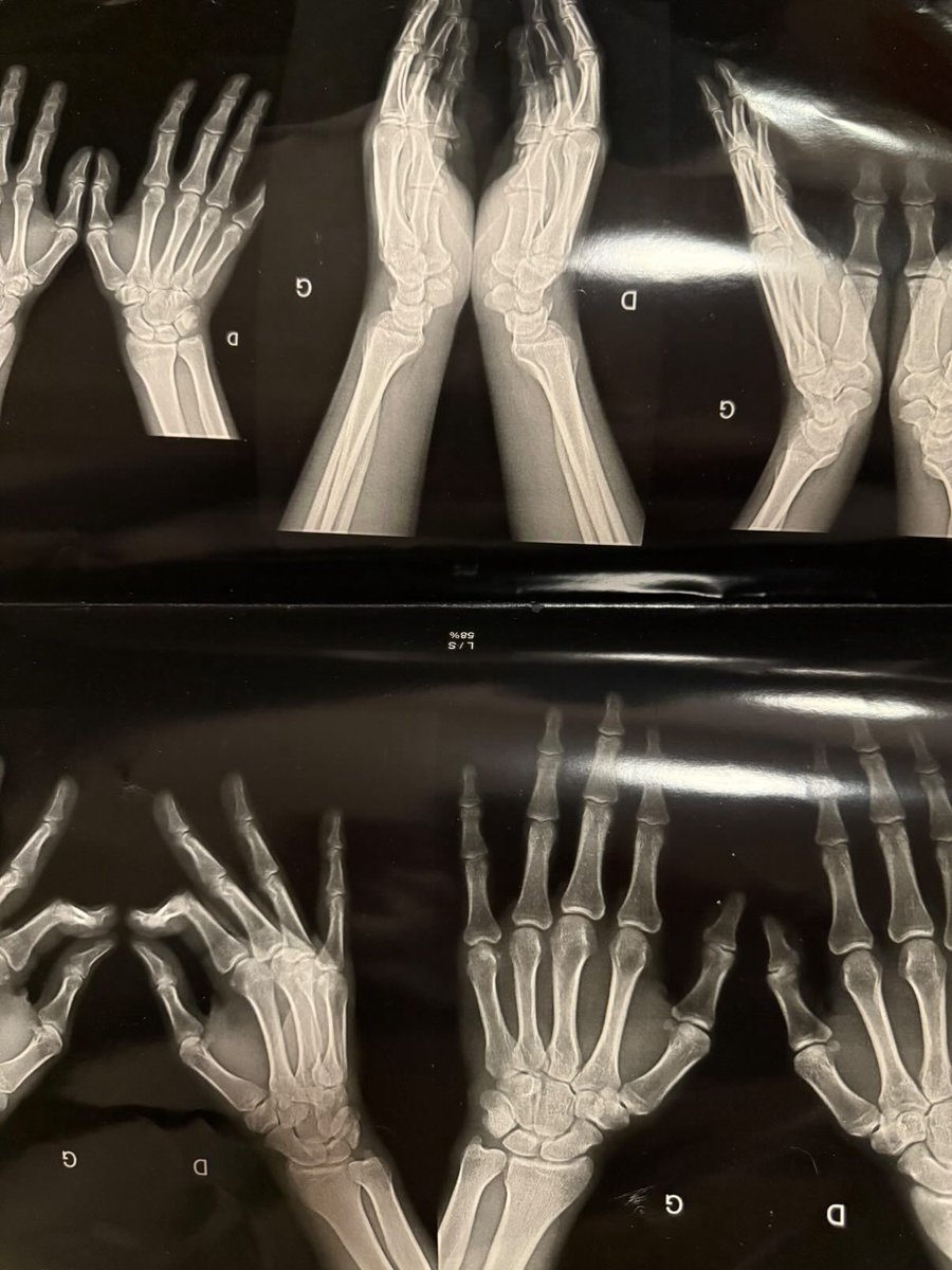 Tout arrive pour une raison.

Je crois en Dieu, mais peu importe vos convictions : ne laissez jamais une mauvaise passe devenir une fatalité. Il y a toujours quelque chose à apprendre dans la perte.

Il y a quelques années, j’ai perdu mes bras. Littéralement. J’avais arrêté le