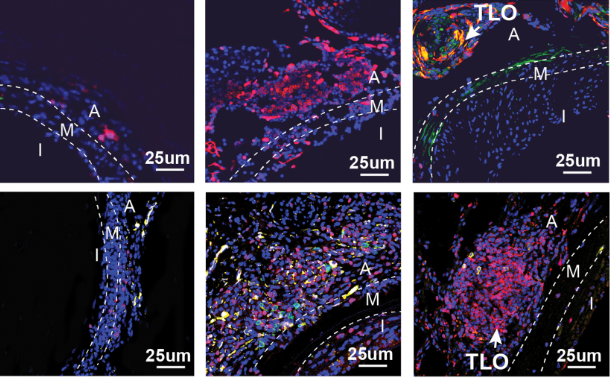 Immune_News's tweet image. 💡 Researchers provided insights into the critical role of #mitochondrial 1-carbon metabolism and MTHFD2 in governing the differentiation of CD34-lineage cells into Tfh cells.
@CircAHA | bit.ly/4et8sCW