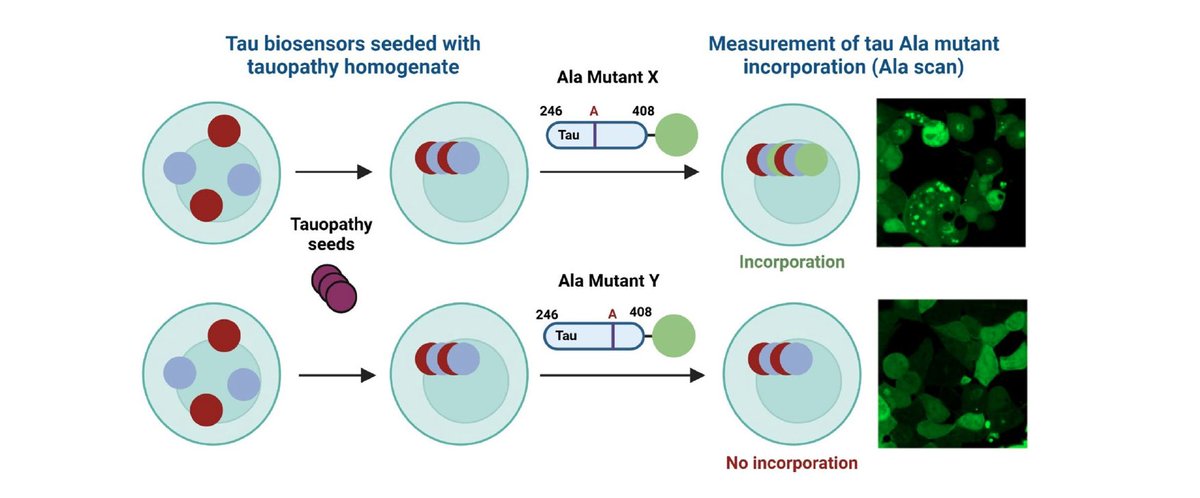 UTSWNeurology's tweet image. UTSW neurologists and their collaborators published “Essential tremor with tau pathology features seeds indistinguishable in conformation from Alzheimer’s disease and primary age-related tauopathy” in Acta Neuropathologica: bit.ly/44oaYXm

#brain #Alzheimers #science