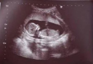 Shimaa from Gaza (@shimaabasam) on Twitter photo 🚨PLEASE DON'T SKIP ME🚨
My pregnant sister is sleep without food or drink and ,she live in great tension, and need vitamens
Every donation will make a difference
Donate here or share🍉👇
gofund.me/23f5594b
<a href="/SabirMehmood26/">Sabir Mehmood Hashmi</a> 🚨PLEASE DON'T SKIP ME🚨
My pregnant sister is sleep without food or drink and ,she live in great tension, and need vitamens
Every donation will make a difference
Donate here or share🍉👇
gofund.me/23f5594b
<a href="/SabirMehmood26/">Sabir Mehmood Hashmi</a>