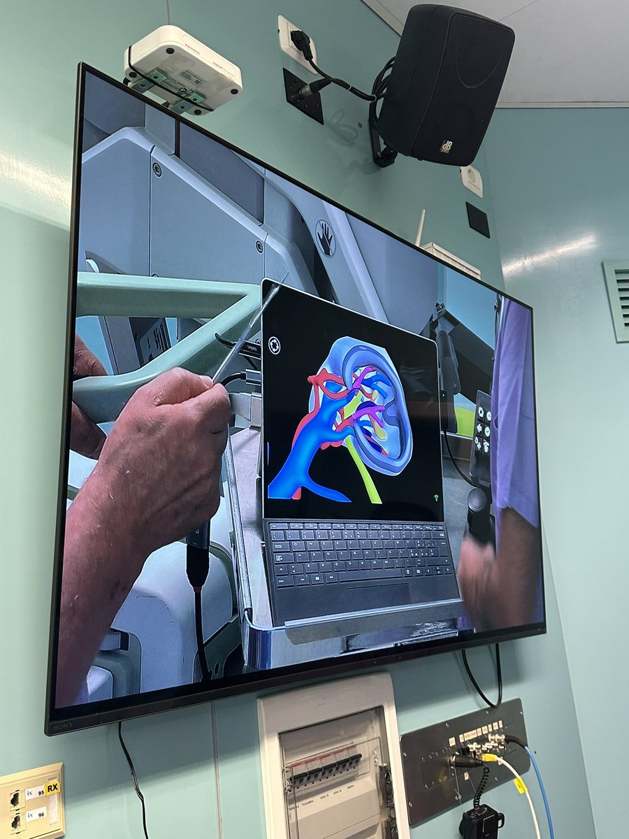 Enrico Checcucci (@enricocheccucci) on Twitter photo Proud and honored to have hosted the Masterclass on partial nephrectomy of <a href="/UrowebESU/">European School of Urology (EAU ESU)</a> at our Institute <a href="/fpoirccs/">Istituto di Candiolo - FPO IRCCS</a> . Two days of high-level lectures and educational surgeries. Thank you to all speakers and participants! Proud and honored to have hosted the Masterclass on partial nephrectomy of <a href="/UrowebESU/">European School of Urology (EAU ESU)</a> at our Institute <a href="/fpoirccs/">Istituto di Candiolo - FPO IRCCS</a> . Two days of high-level lectures and educational surgeries. Thank you to all speakers and participants!