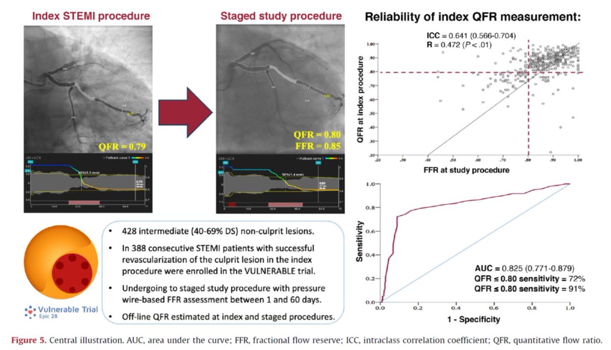 JuanSanchisFor's tweet image. The index QFR shows good diagnostic accuracy in identifying non-culprit intermediate lesions with positive FFR in a staged procedure, which may help avoid such staged procedures. Read this article published in @RevEspCardiol by @josepgomezlara @shci_sec
revespcardiol.org/en-diagnostic-…