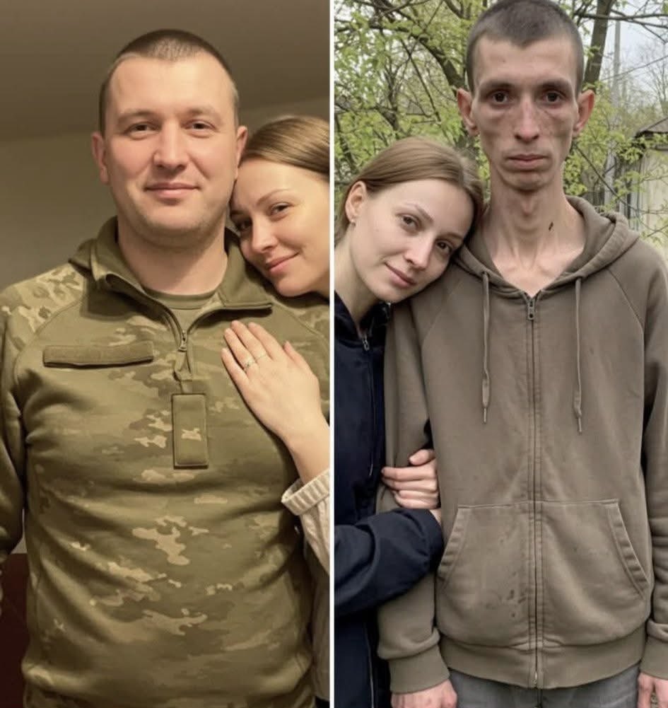 Вот такими украинцы возвращаются из российского плена и это не единственный случай, мы все видели эти фото, то что орки делают с нашими пленными не укладывается в голове…