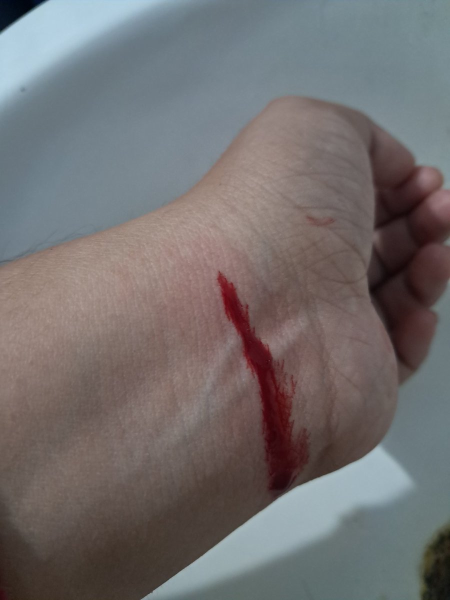 Kittyfl4n's tweet photo. Por alguna razon me duele mucho más cuando es en la muñeca 
#shtwtᅠ https://t.co/KMK6POlZtl
