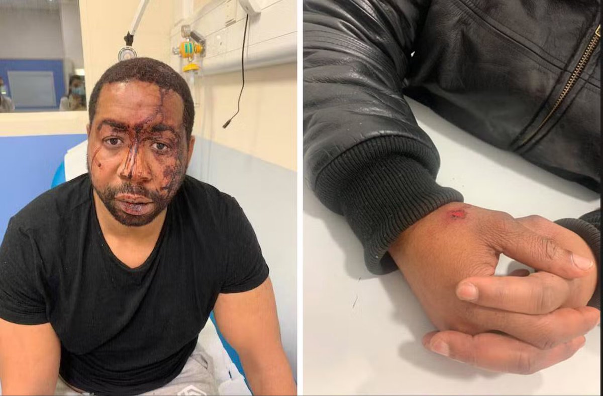 Aurélien L., 28 ans, Philippe T., 48 ans, et Pierre P., 36 ans, trois des policiers ayant passé à tabac Michel Zecler seront jugés devant la la cour criminelle départementale de Paris.

Une avalanche de coups gratuits aux cris de « sale nègre » qui a duré quatre minutes.