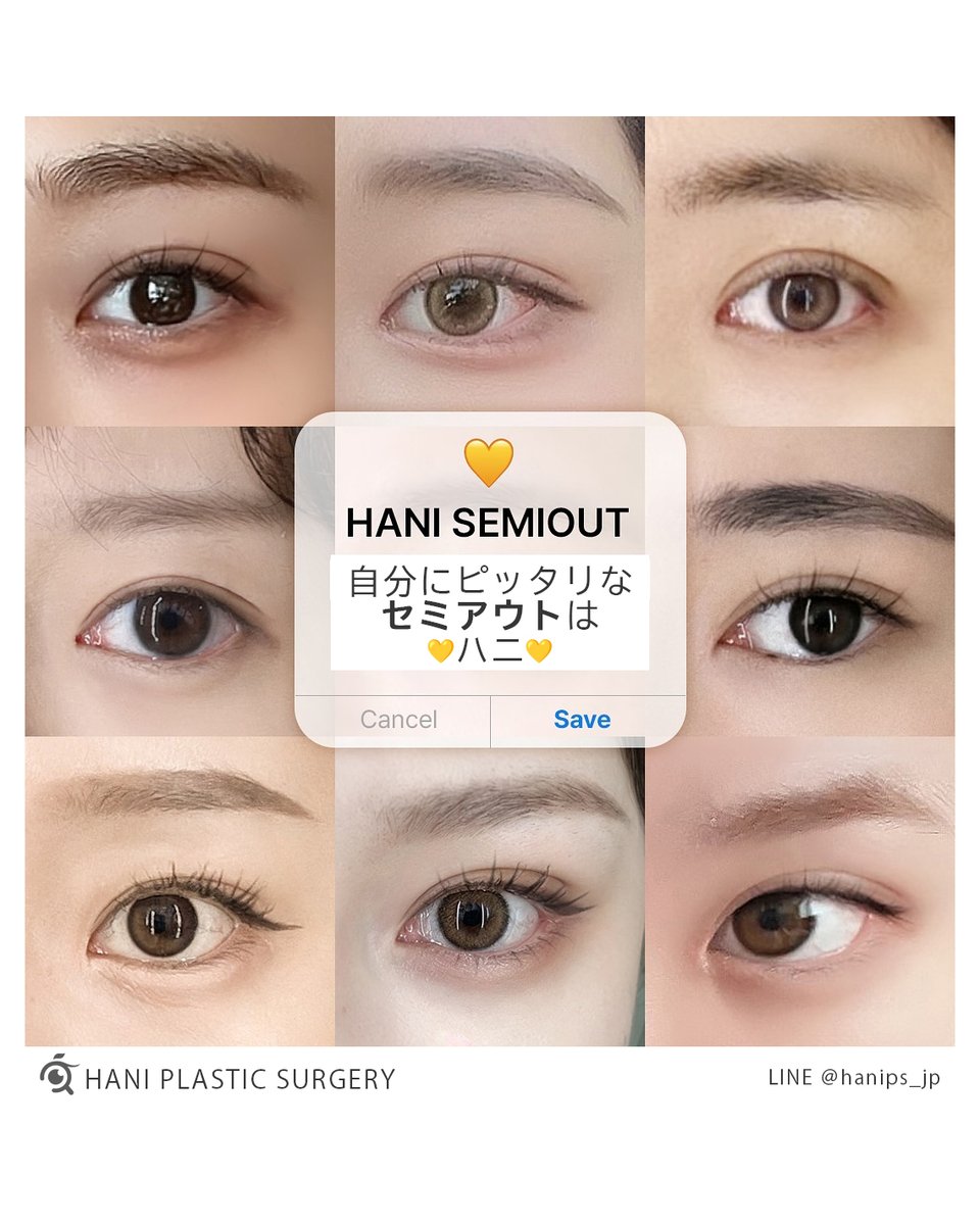 hanips_jp's tweet photo. 自然＋華やか➡ハニのセミアウト＋カラコントゥイム

✨今よりすっきり拡大✨
あなたが求めている二重手術
理想な目の形はハニで見つけてね‼

元祖セミアウトはハニのチェジョンフン院長から😎

#セミアウト #二重手術 #カラコントゥイム #目尻切開 https://t.co/uHl8FKOd7n
