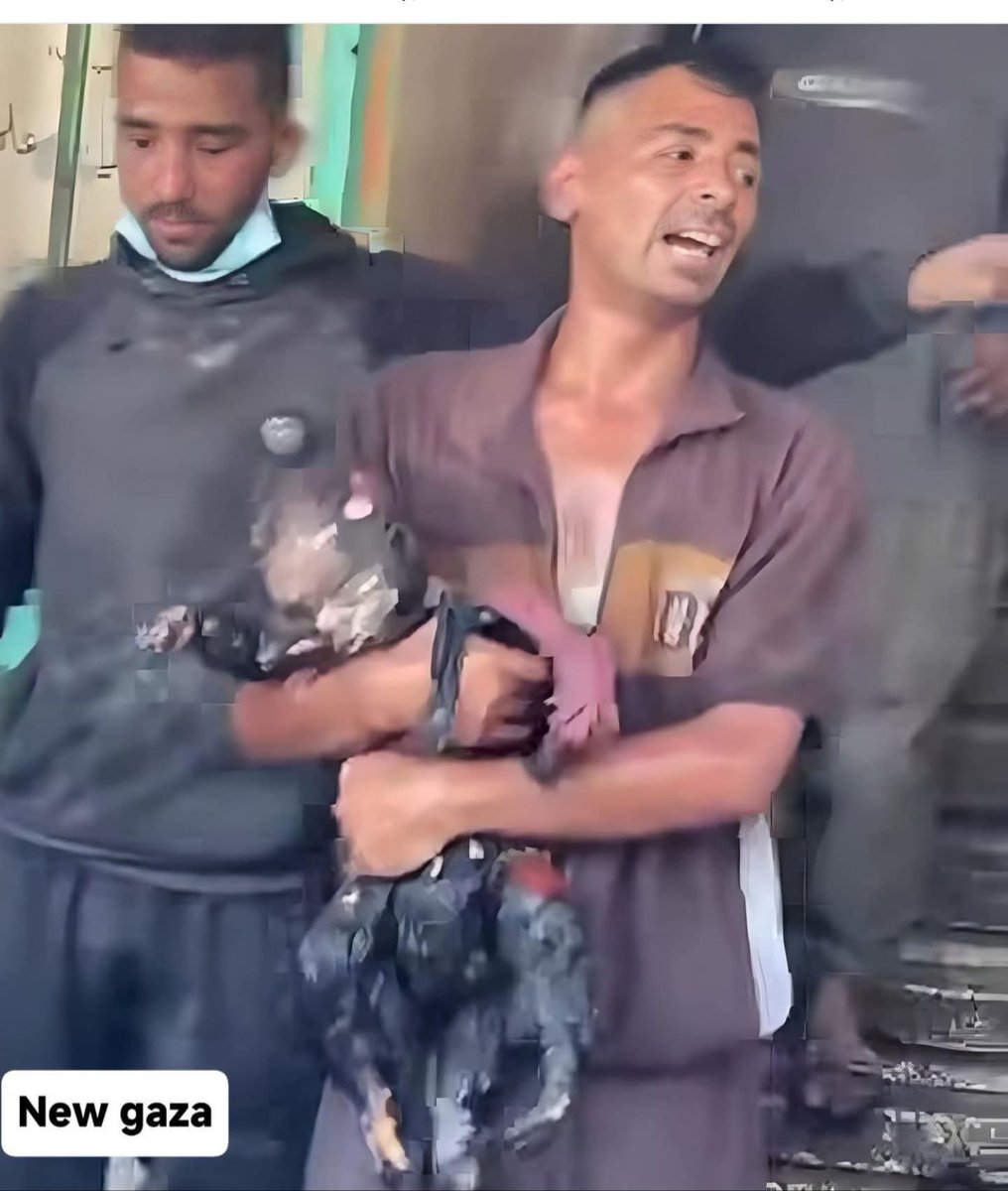 طفلٌ كان قبل لحظات يضحك… يلعب…
أصبح الآن رمادًا في حضن أبيه،
لأن "العالم الحر" قرر أن يصمت.

📢 وجه الحقيقة… وجه الجريمة.

✊ إن لم تبكِ… فاغضب!
وإن لم تغضب… فأنت ميتٌ بقلب ينبض.
#غزة_تباد_بسلاح_أمريكي