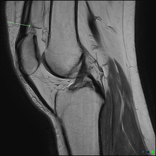 Alabama Orthopedic Imaging tweet media