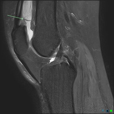 Alabama Orthopedic Imaging tweet media