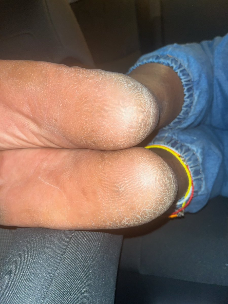 V Goddess Divine sz9’s #FormerlySheGotTheFeet tweet media