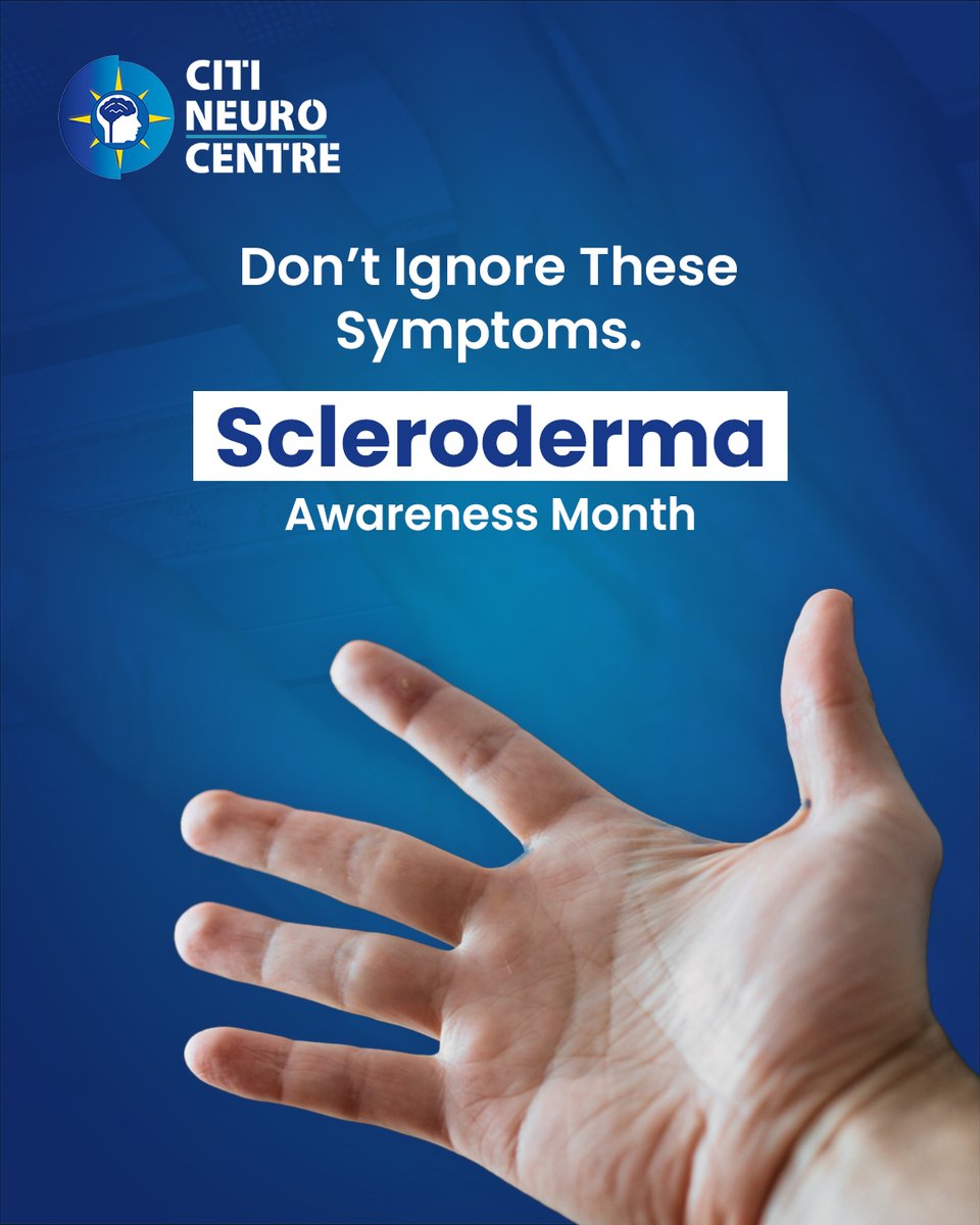 citineurocentre's tweet image. Is your skin trying to tell you something?
Unusual changes in your hands or joints, or discomfort while eating, might be more than just routine signs of aging. 
#SclerodermaAwarenessmonth #Sclerodermaawareness #Raredisease #chronicillness #KnowTheSigns #CNCHospitals